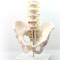 PELVIS05 (12342) modèle médical médical professionnel grandeur nature bassin avec 5pcs anatomie vertébrale lombaire